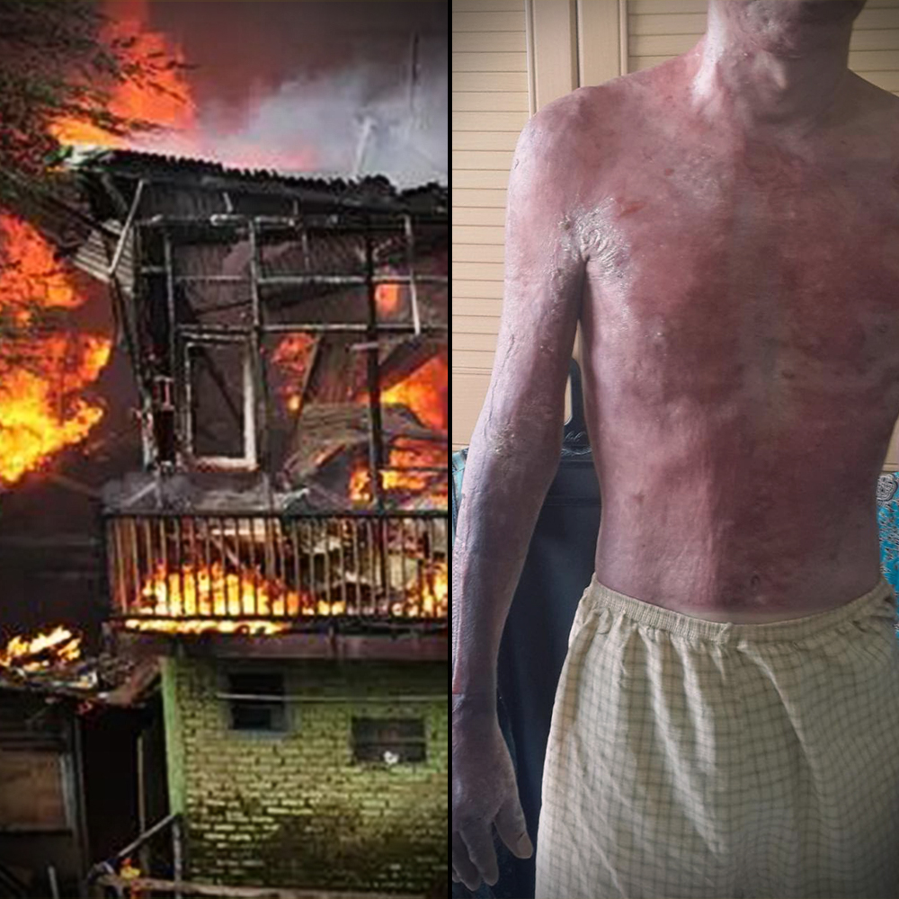 bahaya kompor konvensional