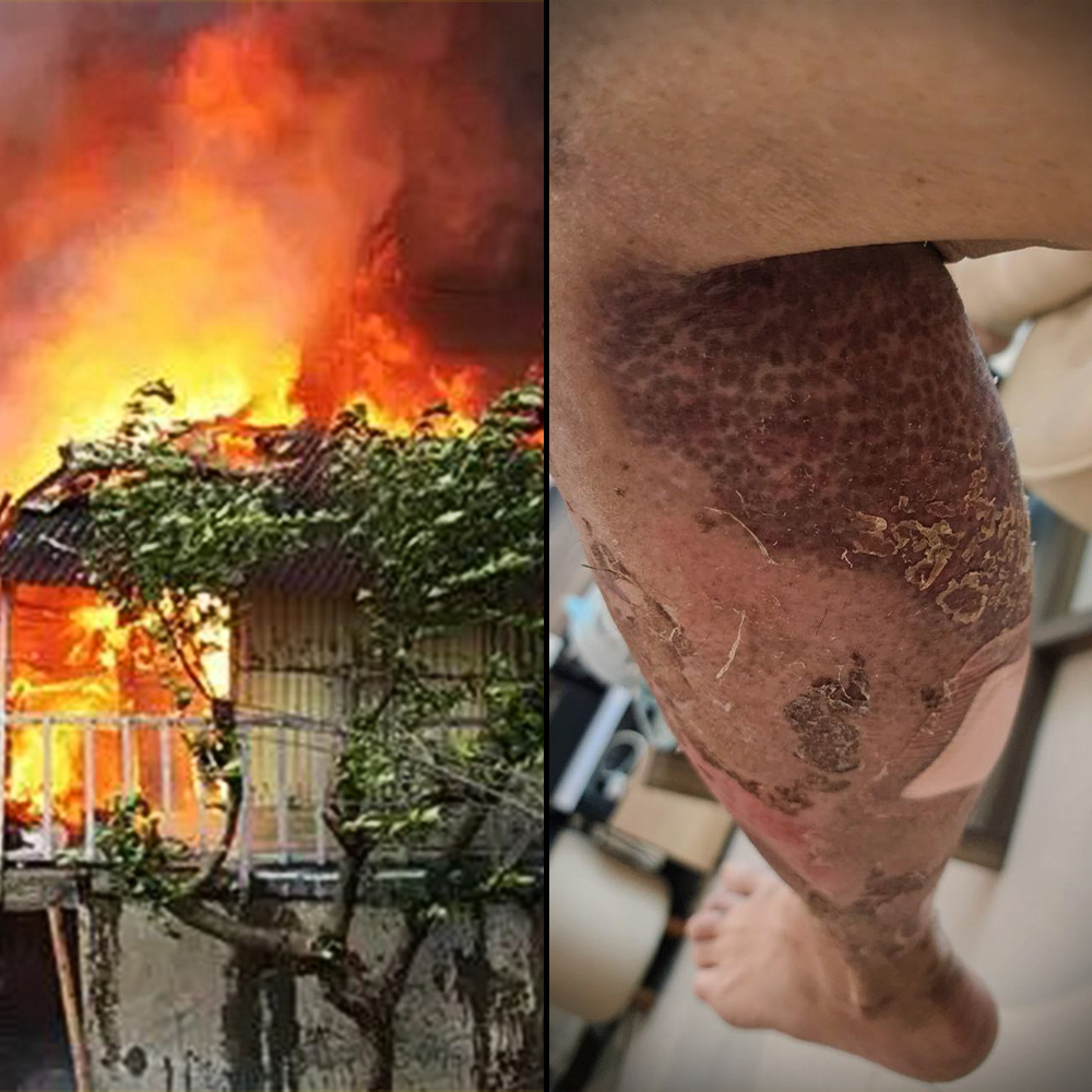 bahaya kompor konvensional